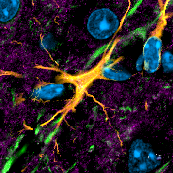 Up close hippocampal neuropil in the CA1 stratum radiatum for today's #fluorescencefriday featuring neurons (🟢MAP2), astrocytes (🟡GFAP), calcium channels (🟣 Cav1.2), and nuclei (🔵DAPI).