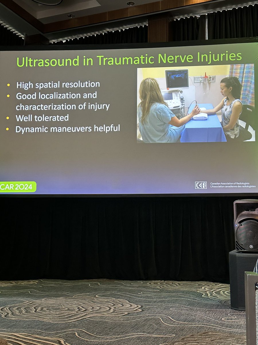 Dr. Emil Lee (@emil_leemd) on Twitter photo <a href="/LJProbyn/">Linda Probyn</a> is both Moderator and Presenter during @CARadiologists #CAR2024 ASM on the “Role of Ultrasound in Traumatic Nerve Injury”!
<a href="/UofTMedIm/">UofT Medical Imaging</a> <a href="/Sunnybrook/">Sunnybrook Health Sciences Centre</a> <a href="/LJProbyn/">Linda Probyn</a> is both Moderator and Presenter during @CARadiologists #CAR2024 ASM on the “Role of Ultrasound in Traumatic Nerve Injury”!
<a href="/UofTMedIm/">UofT Medical Imaging</a> <a href="/Sunnybrook/">Sunnybrook Health Sciences Centre</a>