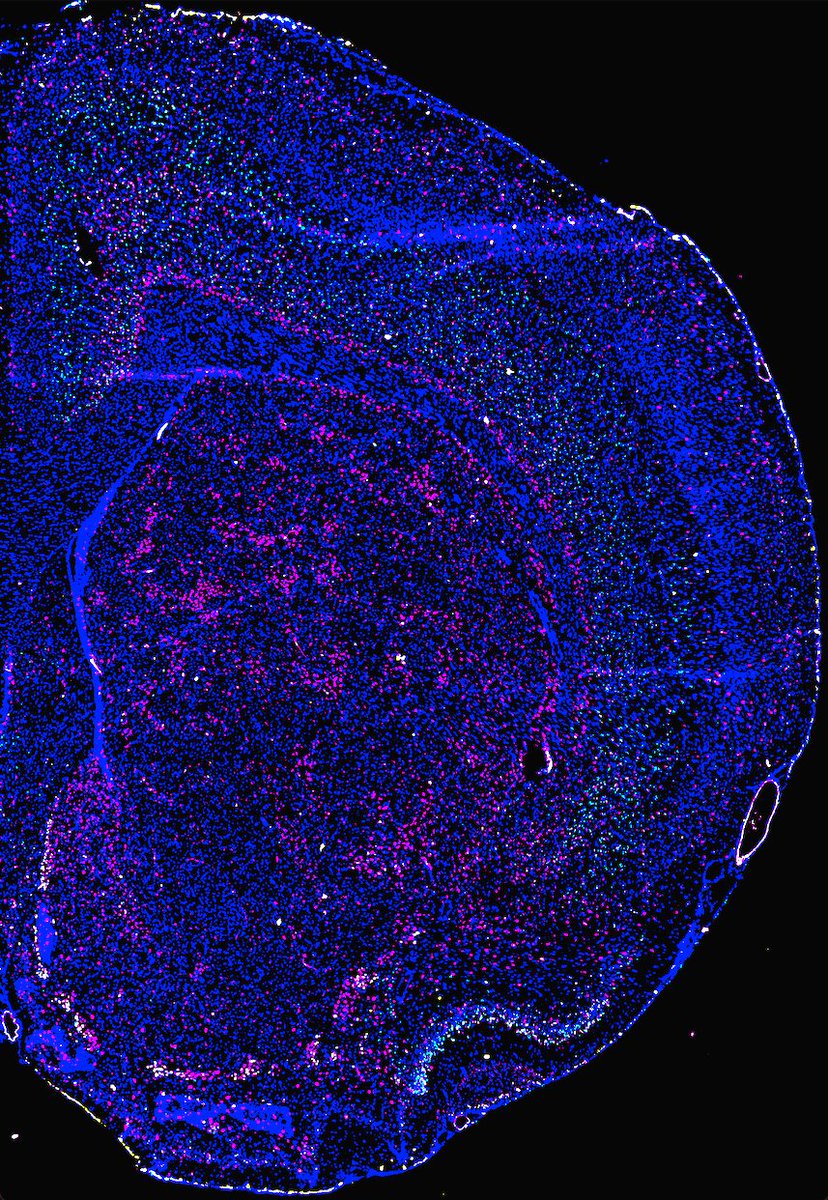 A bit of a throwback for #FluorescenceFriday in celebration of @emma_andraka's manuscript being accepted for publication. RNAscope for the following transcripts in coronal section of a rat brain, with DAPI to mark nuclei. Oprm1 (magenta) Grm8 (cyan) Chst9 (yellow)