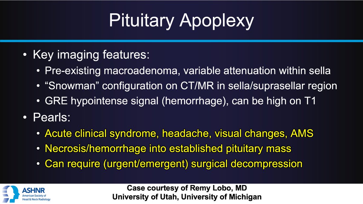 #ASHNRCOTW #248: ANSWER. Thx @remyrlobo 4 case! #ASHNR24 @callyrobs @DShatzkes @CDP_Rad @nakoontz @rhwiggins @KRileyMD @CMGlastonbury @cmtomblinson @tabby_kennedy @PhilipRChapman1 @CynXinWu @AshokSrini15 @MohitAgNeurorad @WmOBrienDO @KatieTraylorDO @kmmosier @pedsneurorad