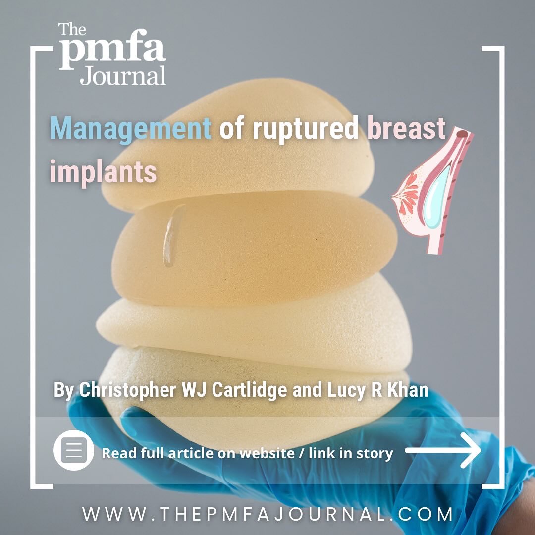 Ruptured breast implants can impact both physical and psychological wellbeing. Learn about the complexities of diagnosis, treatment options, and the evolving landscape of implant technology in this insightful article. 📚Read the article:thepmfajournal.com/features/featu…