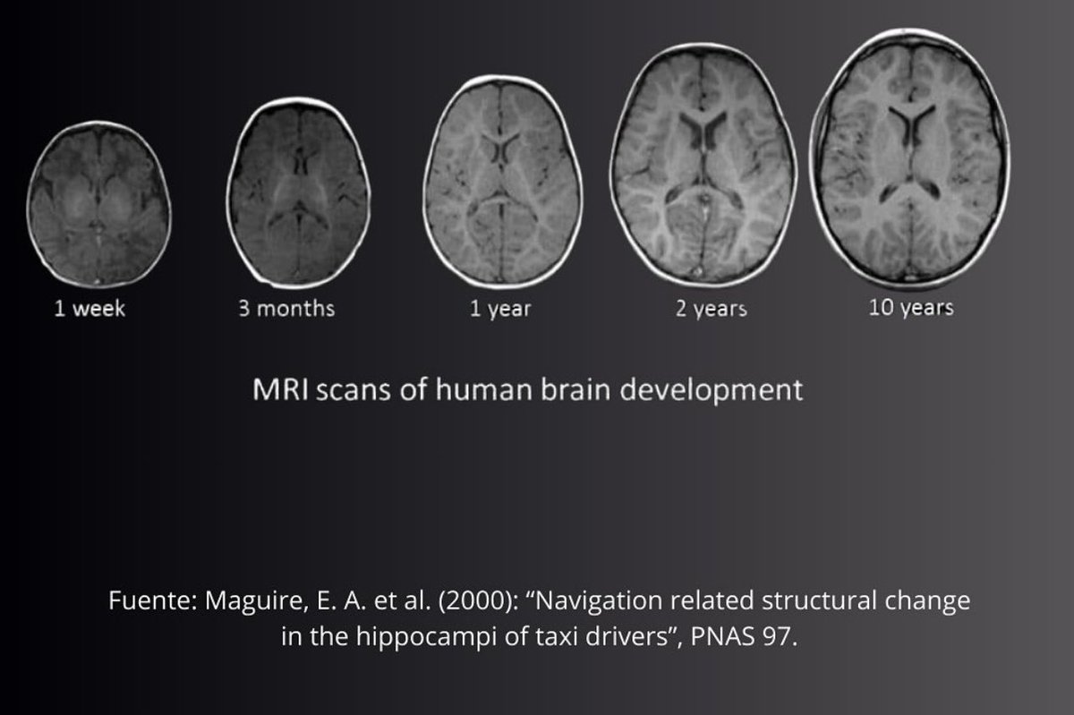 OGdukeneurosurg's tweet photo. How the brain changes overtime in our youth https://t.co/6QFOhrwxlG