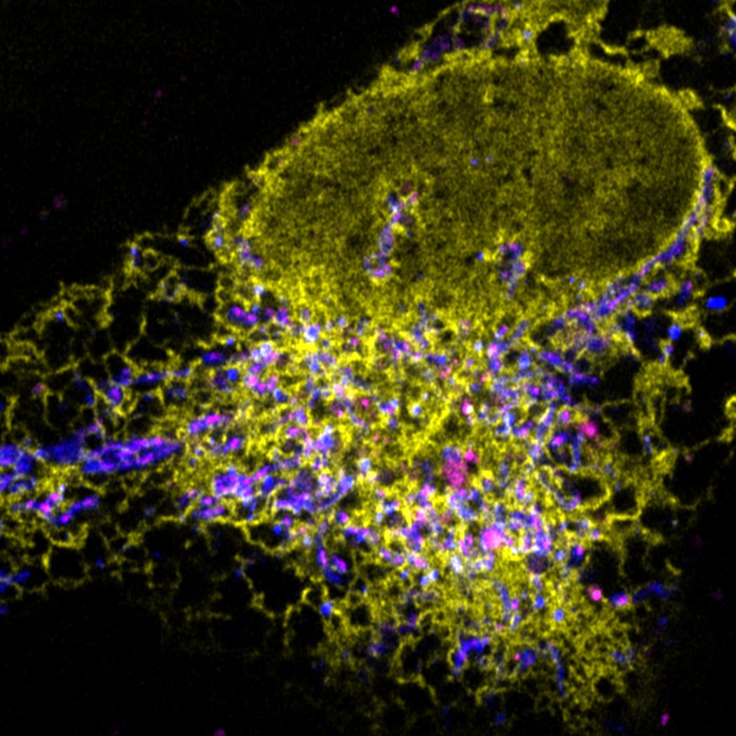 In their @NaturelCellBio publication, @manorlaboratory + Gerry Shadel’s groups propose a new model for endosome-mediated removal and disposal of dysfunctional mtDNA nucleoids, with implications for studying pathogenic inflammation & aging bit.ly/3STfojl