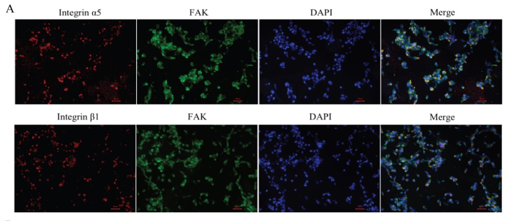 New work from researchers at @FudanUni has investigated the role of integrin α5β1 and FAK in patients with acute type A #AorticDissection, as well as the potential underlying mechanisms. Read the paper: bit.ly/4avzuXe