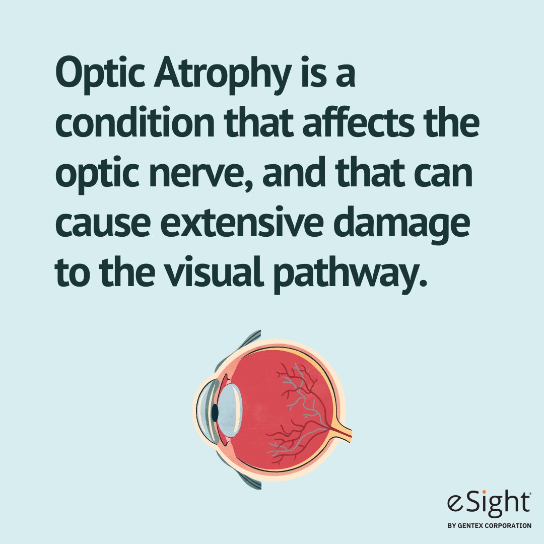 eSightEyewear tweet picture