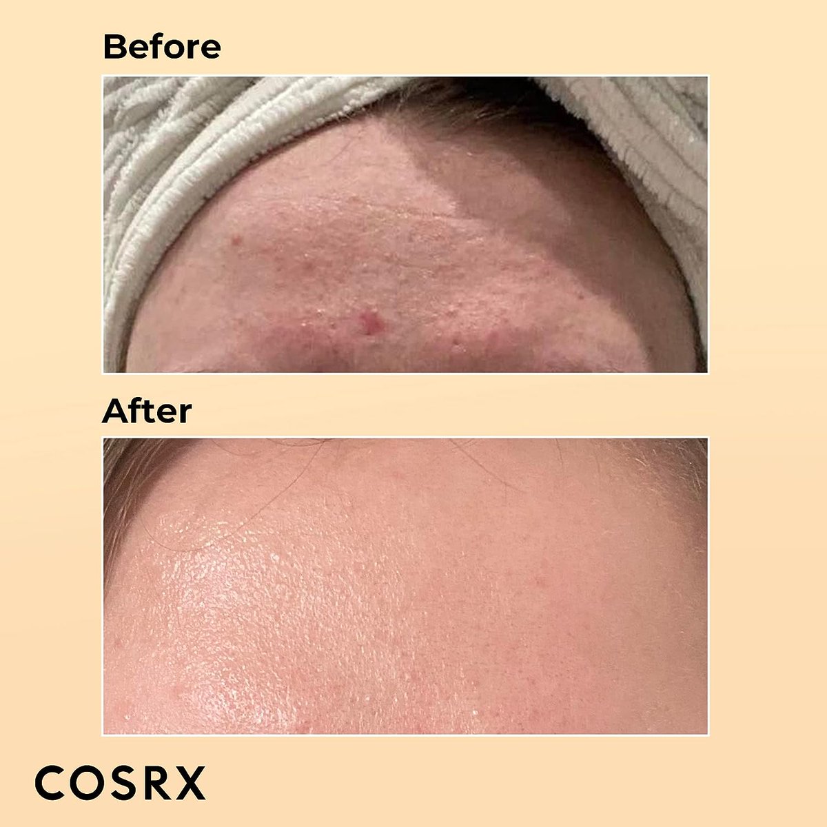 #Wheretobuy 'Revitalize your skin with COSRX Snail Mucin Essence! 🐌✨ This hydrating serum packs 96% snail secretion filtrate to combat dullness and fine lines.  #COSRX #SnailMucin #KoreanSkincare #Hydration #SkinRepair' get now amzn.to/3VVSM3x
