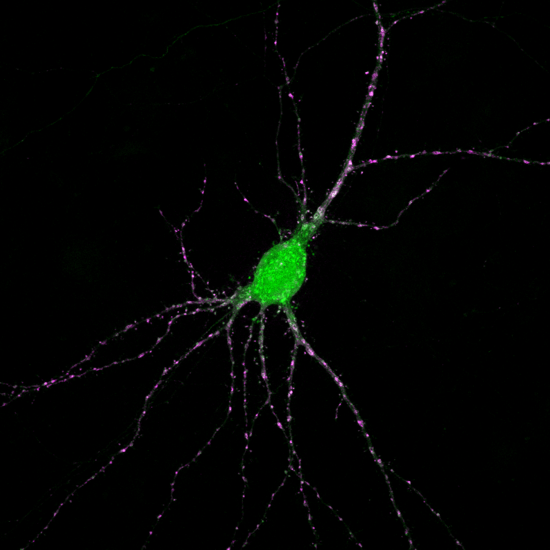 Love how the colors turned out in this primary hippocampal neuron! Happy #FluorescenceFriday