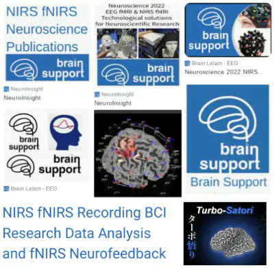 NIRS fNIRS BrainSupport BrainLatam

Workshop NeuroMat NIRS fNIRS Workshop 2024 NIRS-fNIRS This event takes place on April 24, 2024, from 9:00 to 16:00 (BRT)

brainlatamimages.com/blog/nirs-fnir…
