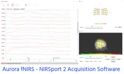 NIRS fNIRS Aurora NIRSport 2 Acquisition Software

Workshop NeuroMat NIRS fNIRS Workshop 2024 NIRS-fNIRS This event takes place on April 24, 2024, from 9:00 to 16:00 (BRT)

iamchurch.com.br/post/nirs-fnir…
