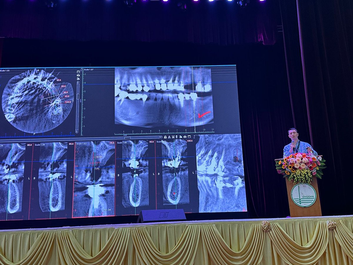 Recently, we hosted an educational dental program in #Vietnam featuring a symposium, consultations, treatments, & student exchanges on #oralhygiene and care. Grateful to our team, @Penn clinicians & @ZimvieDental for their support. Together, we ensure healthy smiles for all!