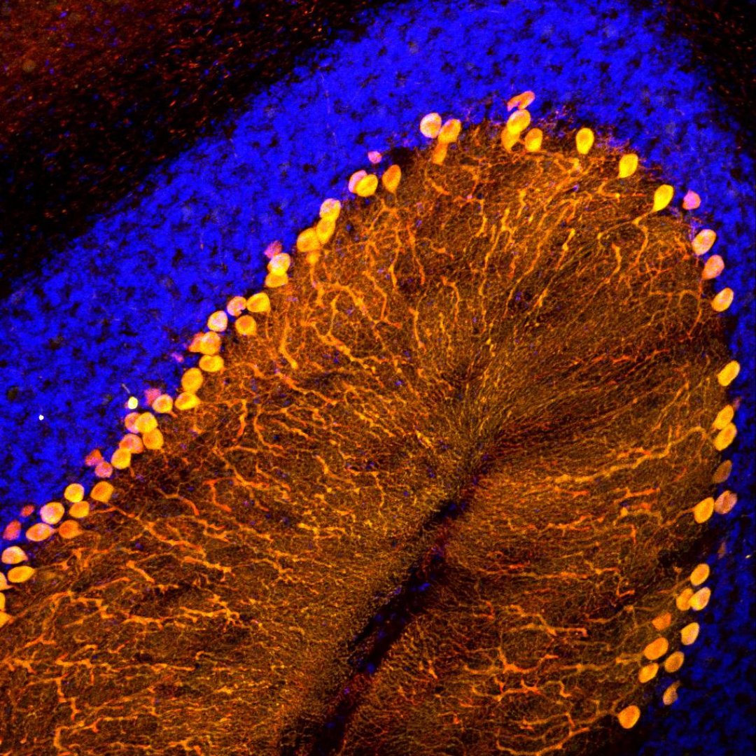 By developing an in vivo CRISPR screening method, @ac4304 + team will study the impact of mutations in 100s of different genes at the same time, within a single animal. In doing so, they hope to uncover determinants of neurodegeneration like spinocerebellar ataxia