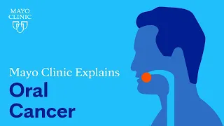 What is oral cancer? Dr. Katharine Price, a medical oncologist @MayoClinic who specializes in #HeadAndNeckCancer talks about #oralcancer, who is at risk, and how early detection can improve chances of successful treatment. bit.ly/3xFxUDB #HeadAndNeckCancerAwareness