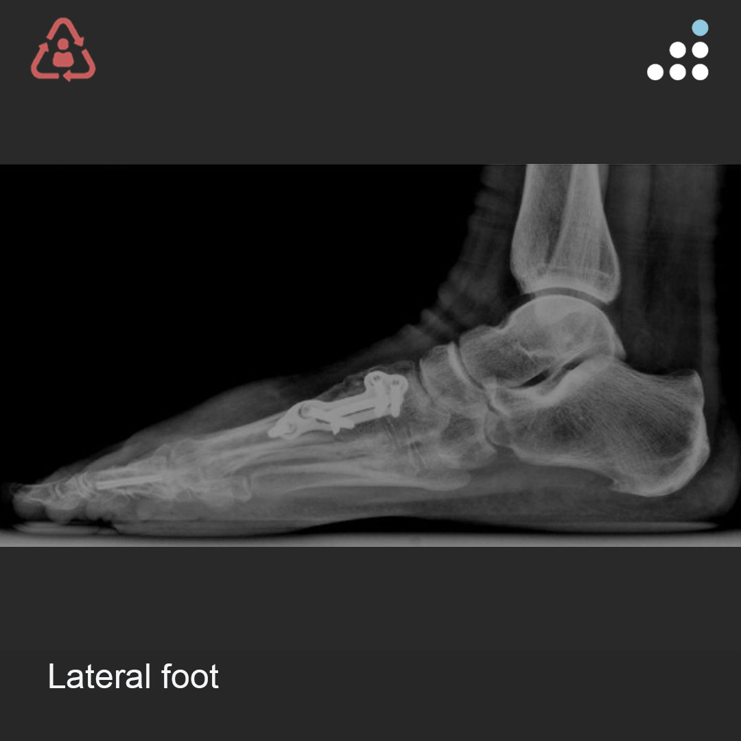 Orthobullets tweet media