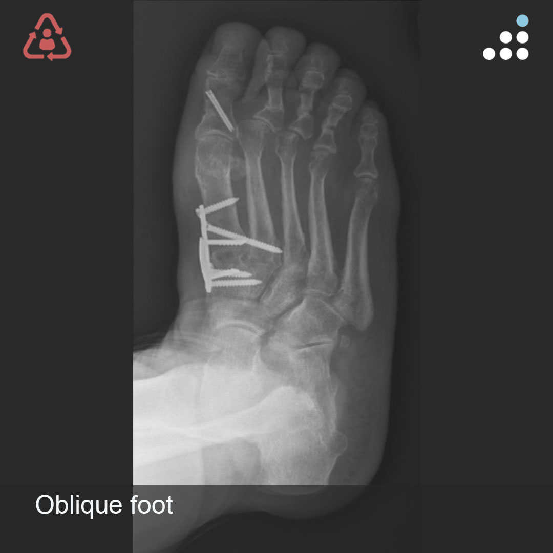 Orthobullets tweet media