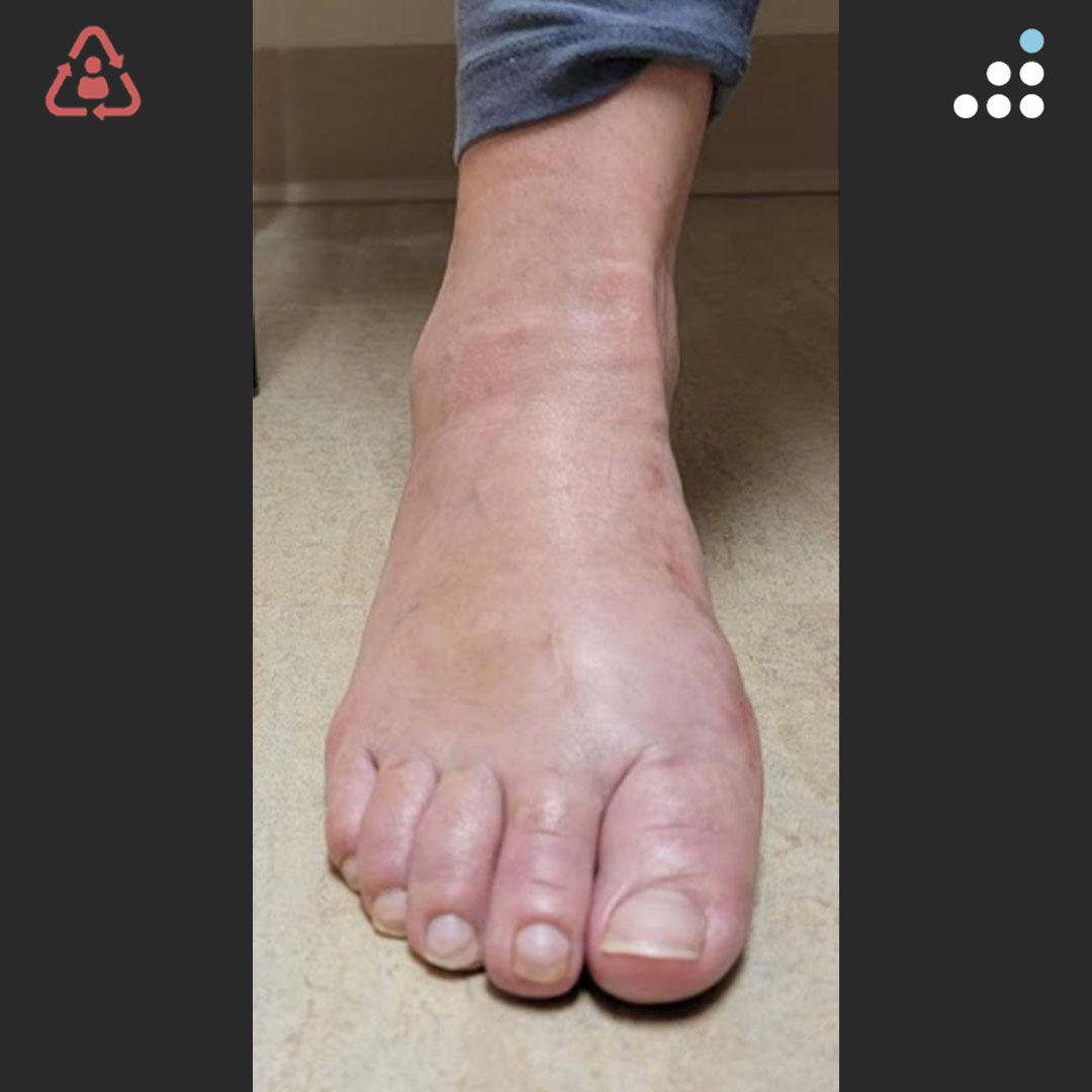 Orthobullets tweet media