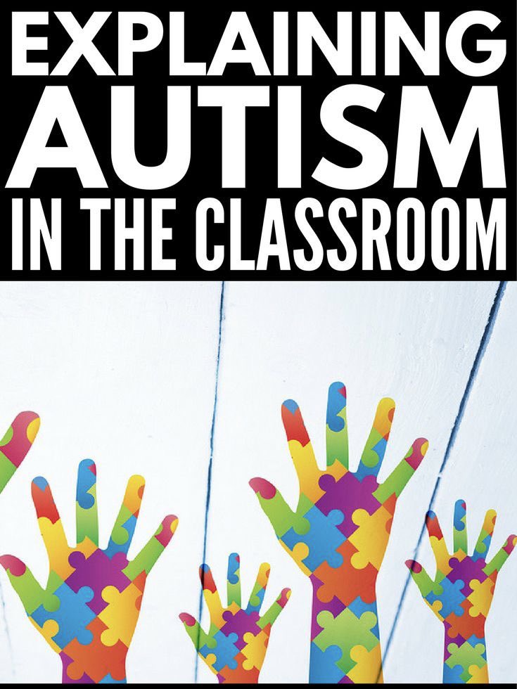 All inclusive type of education means education with no boundaries This month of autism awareness , every child, including those with autism, deserve a chance to shine in school Let's support understanding and diversity in classrooms to help every child succeed @UNICEFUganda