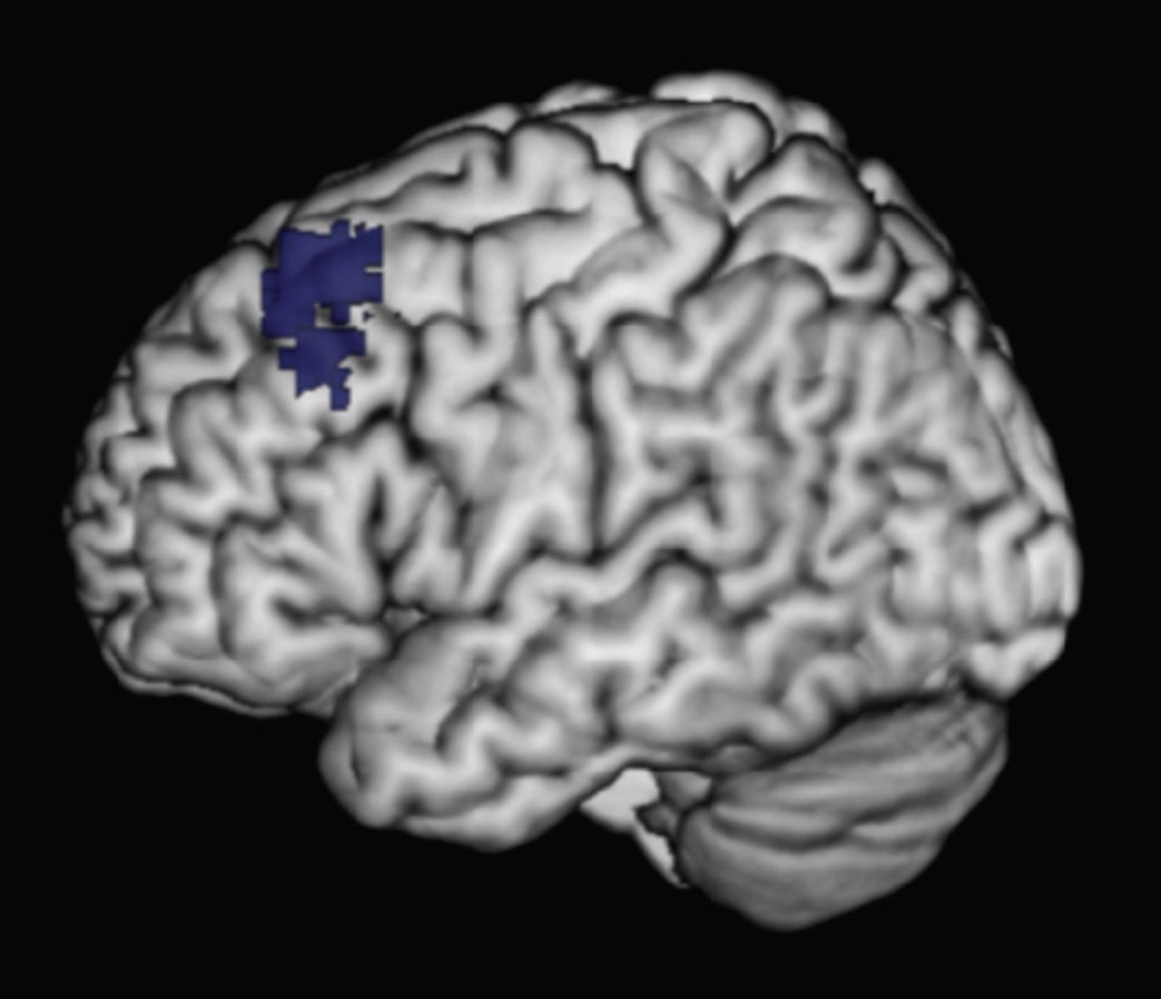 تماشای پورن ساختار مغز رو تغییر میده فعالیت پریفرانتال کورتکس رو ضعیف می‌کنه(قسمتی که مسوول کنترل ایمپالس، تصمیم‌گیری منطقی و خیلی رفتارهای دیگه‌ست که آدم بالغ رو از بچه‌ها تمیز میده) نتیجه:مغز شبیه مغز بچه‌ها میشه شبکه دوپامین رو هم آسیب میزنه نتیجه: مغز شبیه مغز معتادا میشه