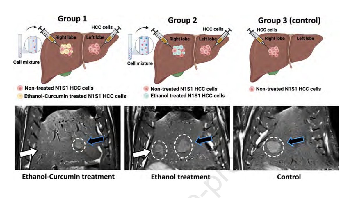 🌟 Exciting findings in @JVIRmedia: Immuno-ethanol ablation as a novel weapon against hepatocellular carcinoma (HCC)! @SIRspecialists Let's dive in! 🧬🔥 Study's Focus: • Understanding the synergy of ethanol and curcumin in HCC treatment. • Explored cellular responses,…