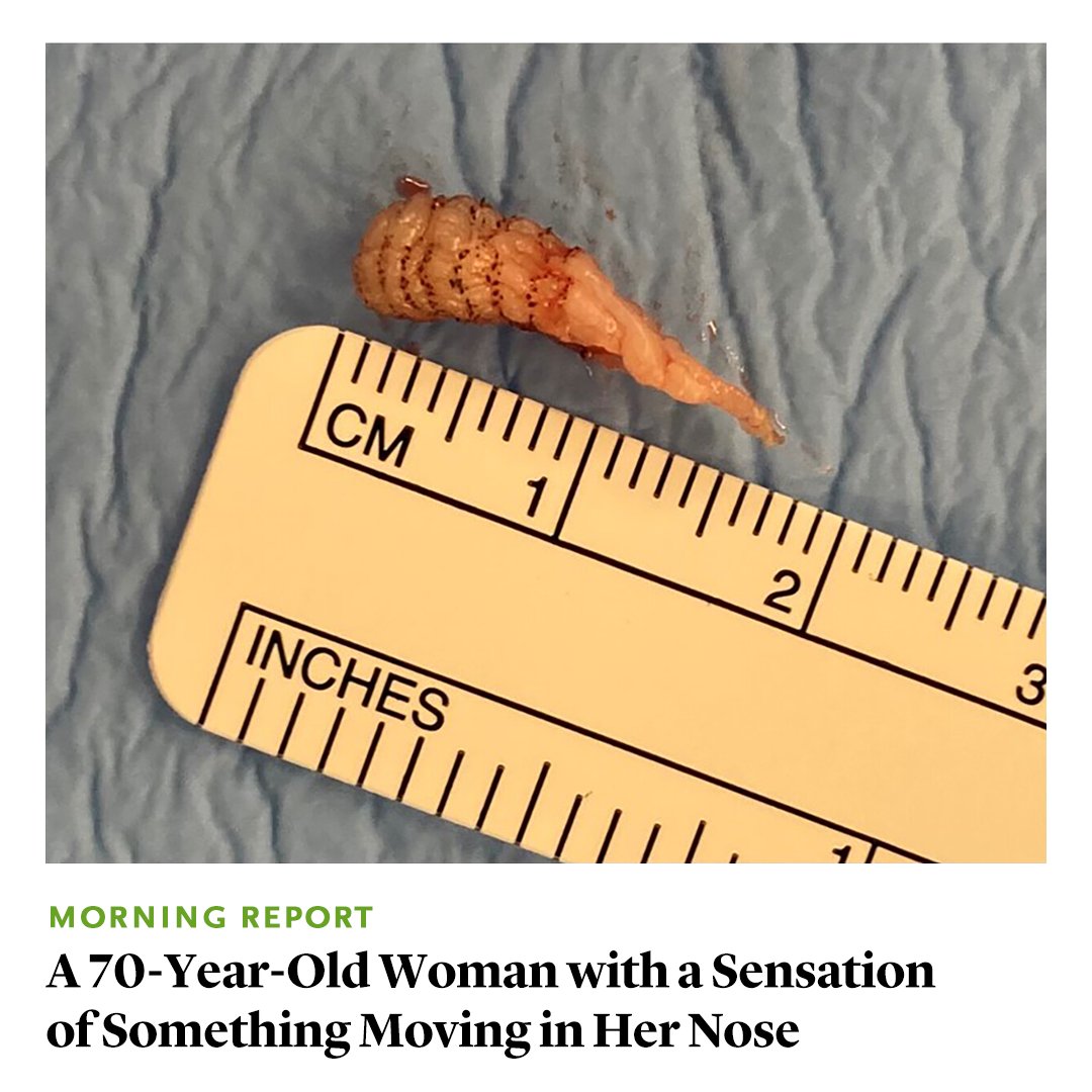 A 70-year-old woman sought evaluation for a sensation of something moving in her nose. The sensation began during a trip to South America. What is the differential diagnosis? Read the Morning Report by Marlene M. Speth, MD, MA, et al.: eviden.cc/3IMTx7l