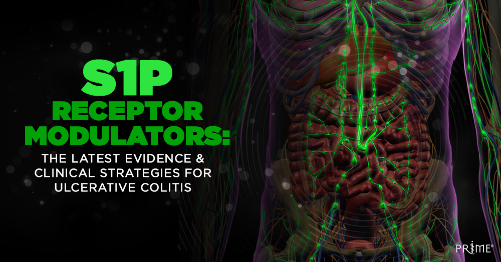 Don't fall behind… stay in the know with our On-Demand Video! | S1P Receptor Modulators: The Latest Evidence & Clinical Strategies for Ulcerative Colitis | 0.75-hour CME/CE | #MedEd #cme #ulcerativecolitis | bit.ly/3TcU9JS