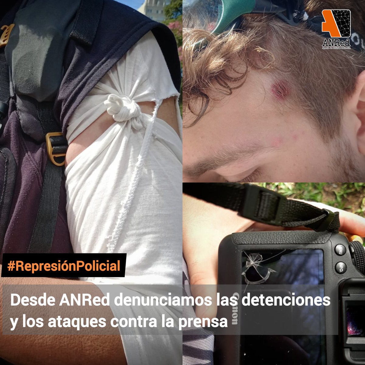 Red__Accion's tweet photo. Desde @Red__Accion en la @RNMA_Arg denunciamos la represión contra nuestro compañero Antonio Becerra que sufrió una herida en el brazo y en la cabeza con disparos de bala de goma.
También las heridas y detenciones a colegas. 
Leer:https://t.co/VG2zYpGmUs https://t.co/oJYRPwAshJ