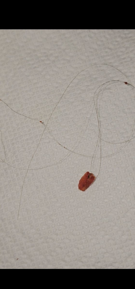 Harry Vawls tweet media