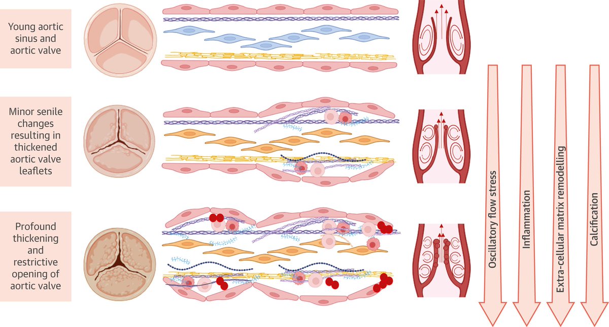 🔴 Noninvasive Techniques for Tracking Biological Aging of the Cardiovascular System: JACC Family Series #OpenAccess #2024Review 

JACC IMAGING ➡️
sciencedirect.com/science/articl…
#echofirst #CardioEd #Cardiology #FOAMed #meded #MedEd #Cardiology #CardioTwitter #cardiotwitter