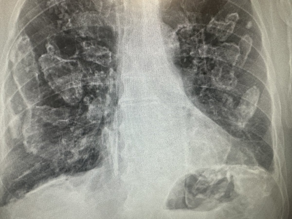 Once you see it, you will never forget it. What is your diagnosis?