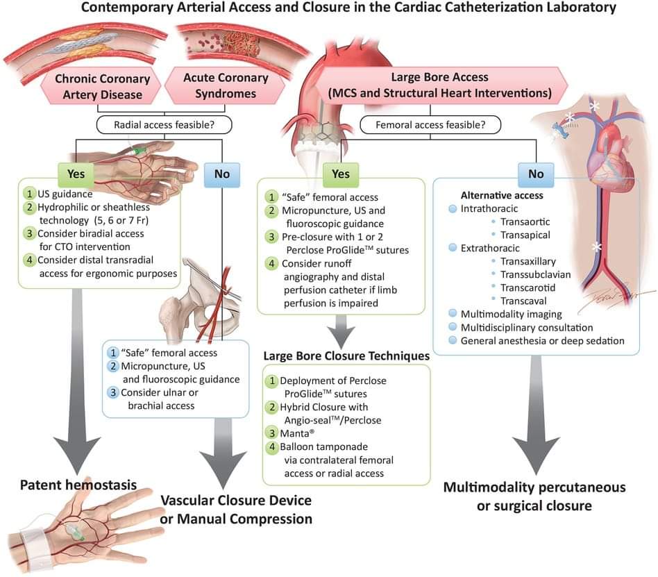 🔴 Best practices for vascular arterial access and closure: a contemporary guide for the cardiac catheterization laboratory #OpenAccess #2024Review 

frontiersin.org/articles/10.33…
#CardioEd #Cardiology #FOAMed #meded #MedEd #Cardiology #CardioTwitter #cardiotwitter #cardiotwiteros