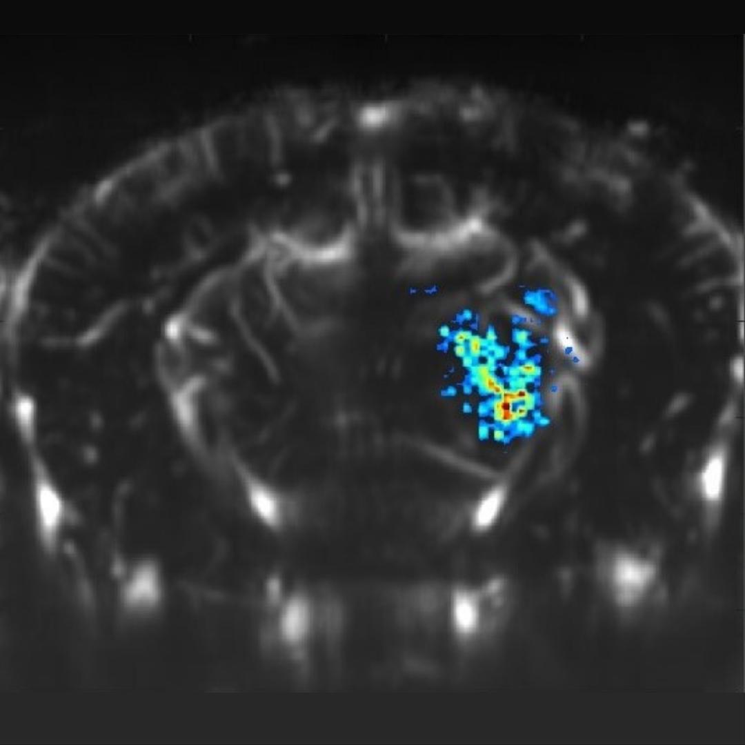 Imagine if we could use ultrasound to detect changes in tumor cells in real-time. @mikhailshapiro is #ImagingTheFuture by creating acoustic biomolecules—the first-of-its-kind contrast agent that will allow ultrasound #tech to image the functions of cells deep in the body