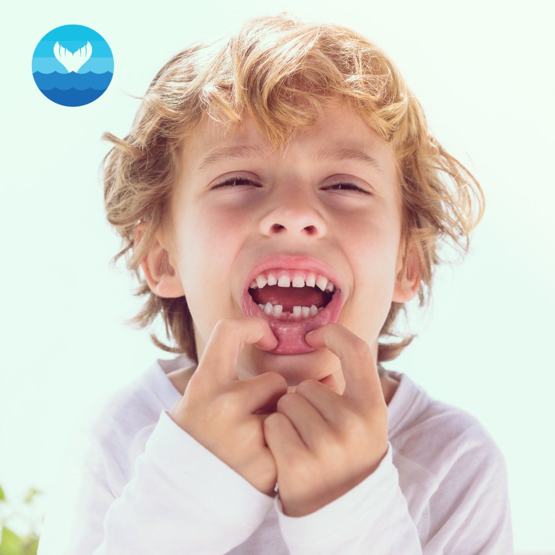 #FunFact: Most children lose their first tooth around 6 years old and will lose their last around 12 years old. 🦷

🤔 Has the Tooth Fairy collected your child’s first tooth yet? 🧚✨

Tell us in the comment section! 💬

#BeachKidsDentistry #PediatricDentistry #ToothFairy