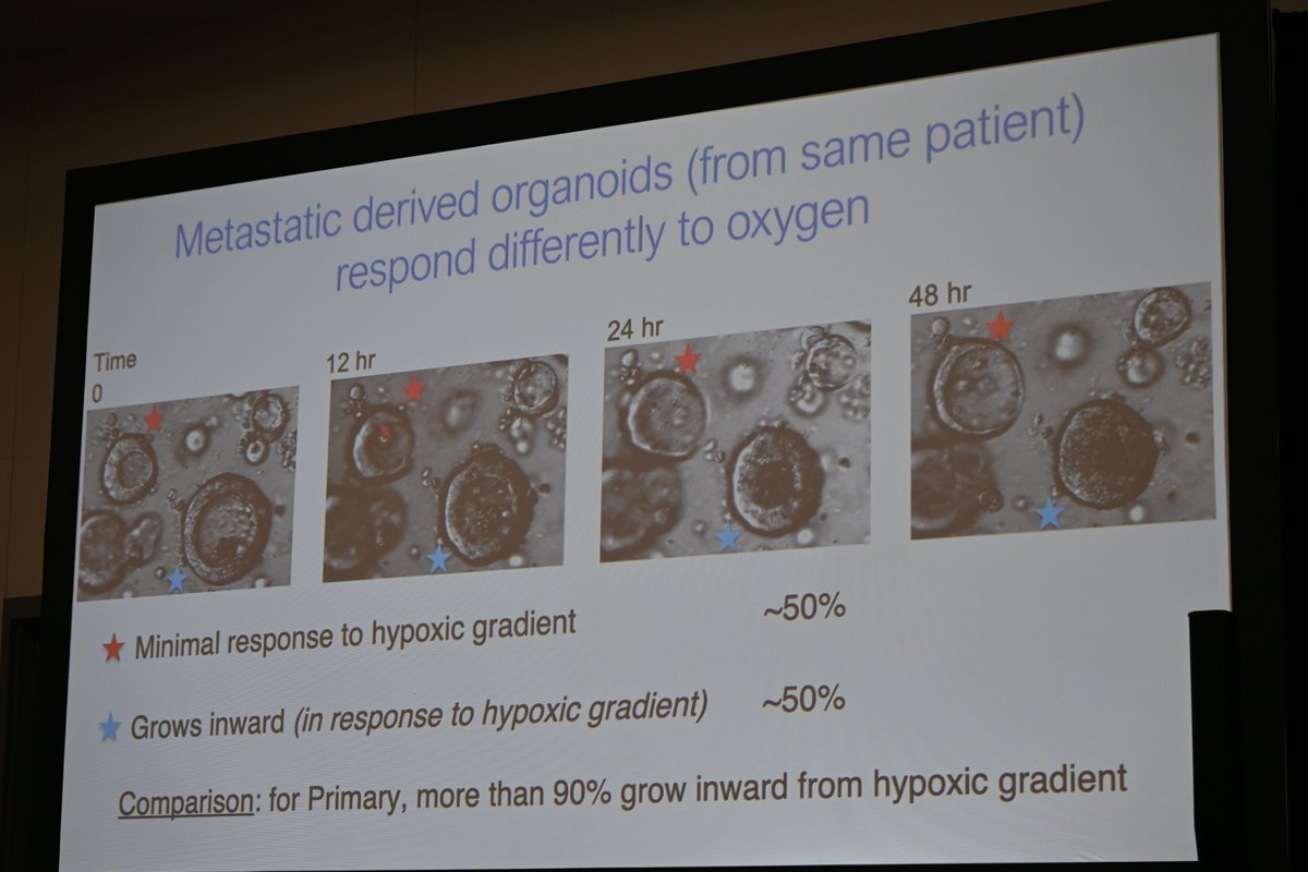 Ludwig @MIT's Scott Manalis delivered a presentation at #AACR24 on how oxygen gradients influence invasion and polarity in organoid models of colorectal cancer.