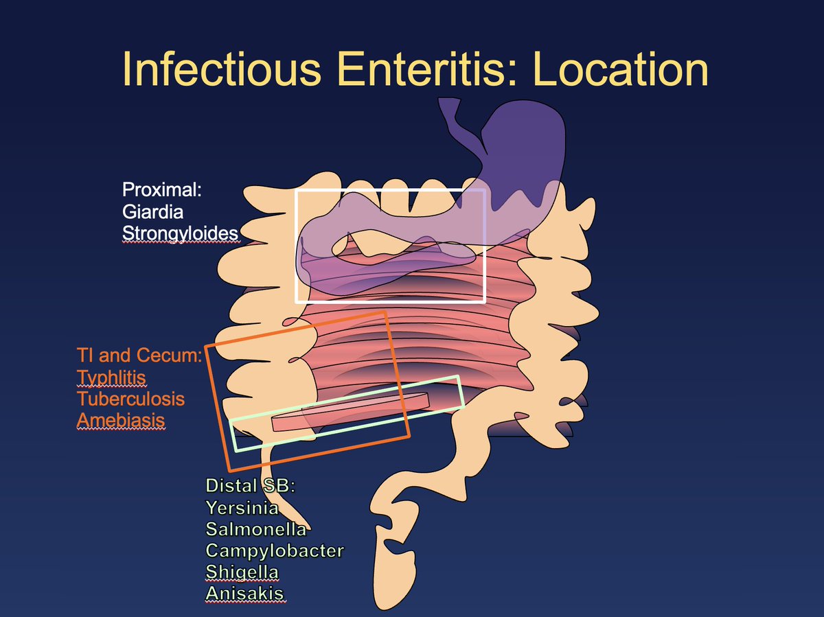 Giardiasis