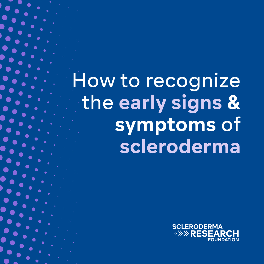 Not enough people know what scleroderma is and does. Even though it's very rare, everyone should know what to watch for as the first signs of scleroderma—including swollen or pufy fingers, joint pain, weight loss, cold sensitivity, & more. Learn more: bit.ly/45gjUw4