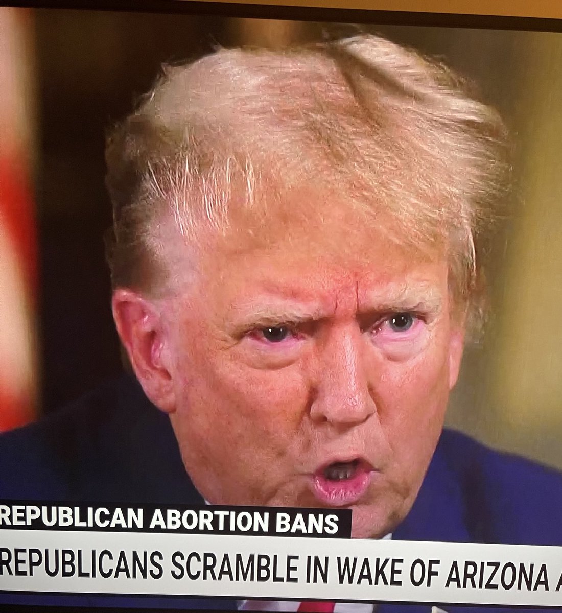 Dead-eyed Donnie lies about being pro-life & anti-abortion. How do I know? Its grotesque circle-lips are moving.
