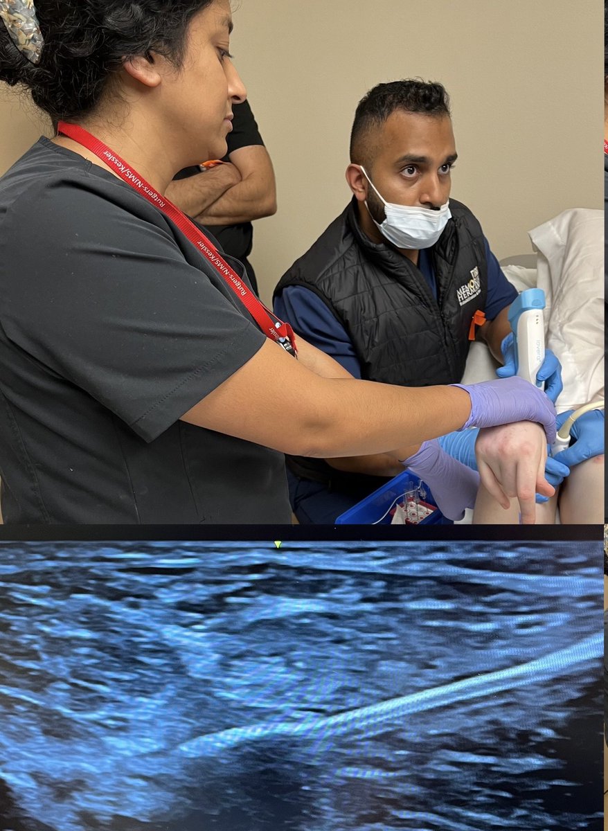 #Spasticity case of the day! #braininjury fellow Dr Tulsi Pandat is teaching graduating resident Dr Vishal Bensal in a #cryoneurolysis procedure. @UTHPMR #physiatry #MedEd #TIRR