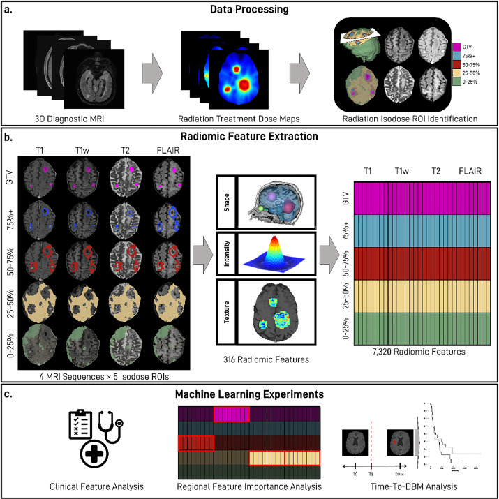 Predicting Distant Brain Metastases from Pre-treatment MRIs - our recently published work @ASTRO_org! Work led by MSTP student @sbubmi, Joseph Bae! Paper: advancesradonc.org/article/S2452-… @stony