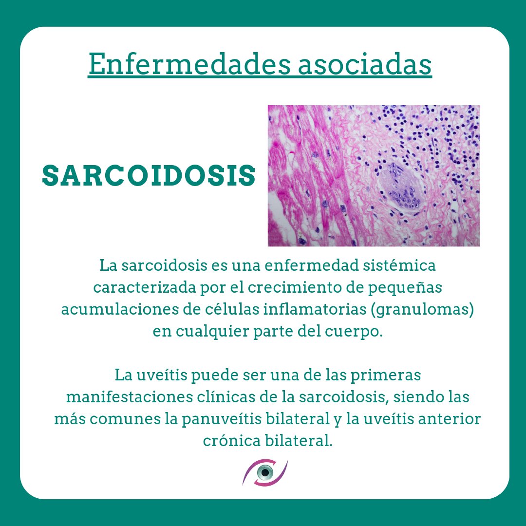 👀 Enfermedades asociadas... #Sarcoidosis 

#asociaciónauvea #auvea2024 #auvea #enfermedadesraras #enfermedadesminoritarias #enfermedadesasociadas #oftalmologia #reumatologia #pediatria #medicinainterna #inmunología #neurología