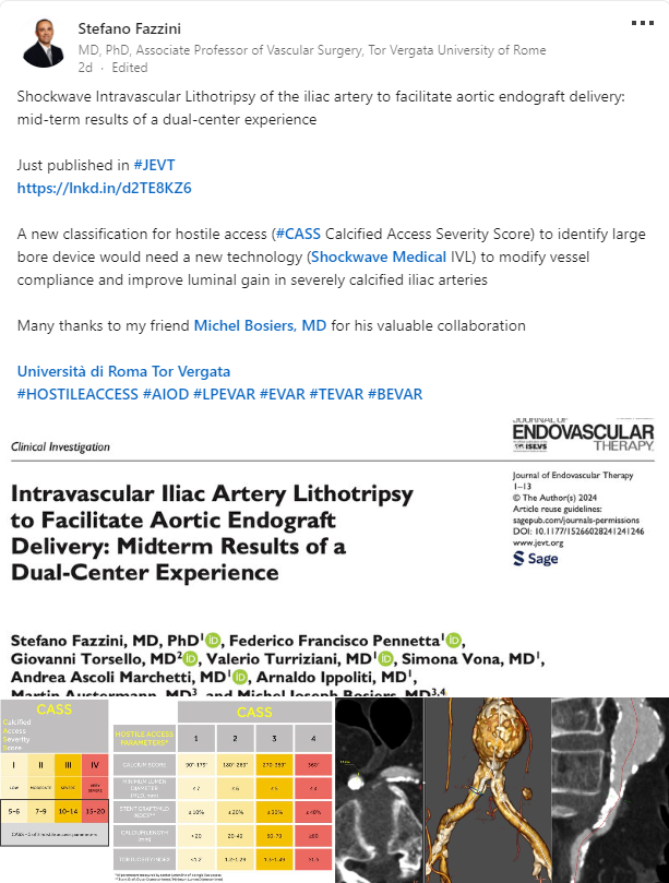 JJMT_CircRest's tweet photo. Fantastic new publication in #JEVT by Prof. @FazziniMd and Dr. Michel Bosiers! 👏 The midterm results of their dual-center experience conclude, “This study shows the safety and feasibility of #ShockwaveIVL as a valuable option to treat narrow and calcified iliac arteries to facilitate endograft delivery.”

Read the JEVT article: https://t.co/kbj0VtsEuD

See his LinkedIn post: https://t.co/Zz4HFMBF8r

US Rx only. ISI https://t.co/x46wohk9Gd #ChangeComplianceChangeTheGame
