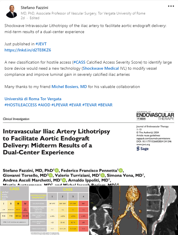 Fantastic new publication in #JEVT by Prof. @FazziniMd and Dr. Michel Bosiers! 👏 The midterm results of their dual-center experience conclude, “This study shows the safety and feasibility of #ShockwaveIVL as a valuable option to treat narrow and calcified iliac arteries to…