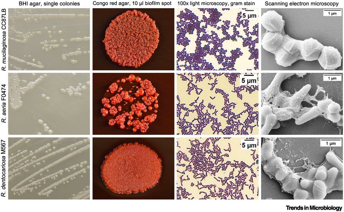 The new Microbe of the Month is Rothia! sciencedirect.com/science/articl… Happy to contribute to this article with @shannonrfulton, Allison Suddaby, and @CBIbberson @TrendsMicrobiol