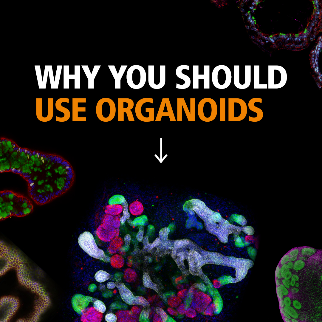 🧵 5 facts about the potential of #organoids in the therapeutic development process! (1/7)