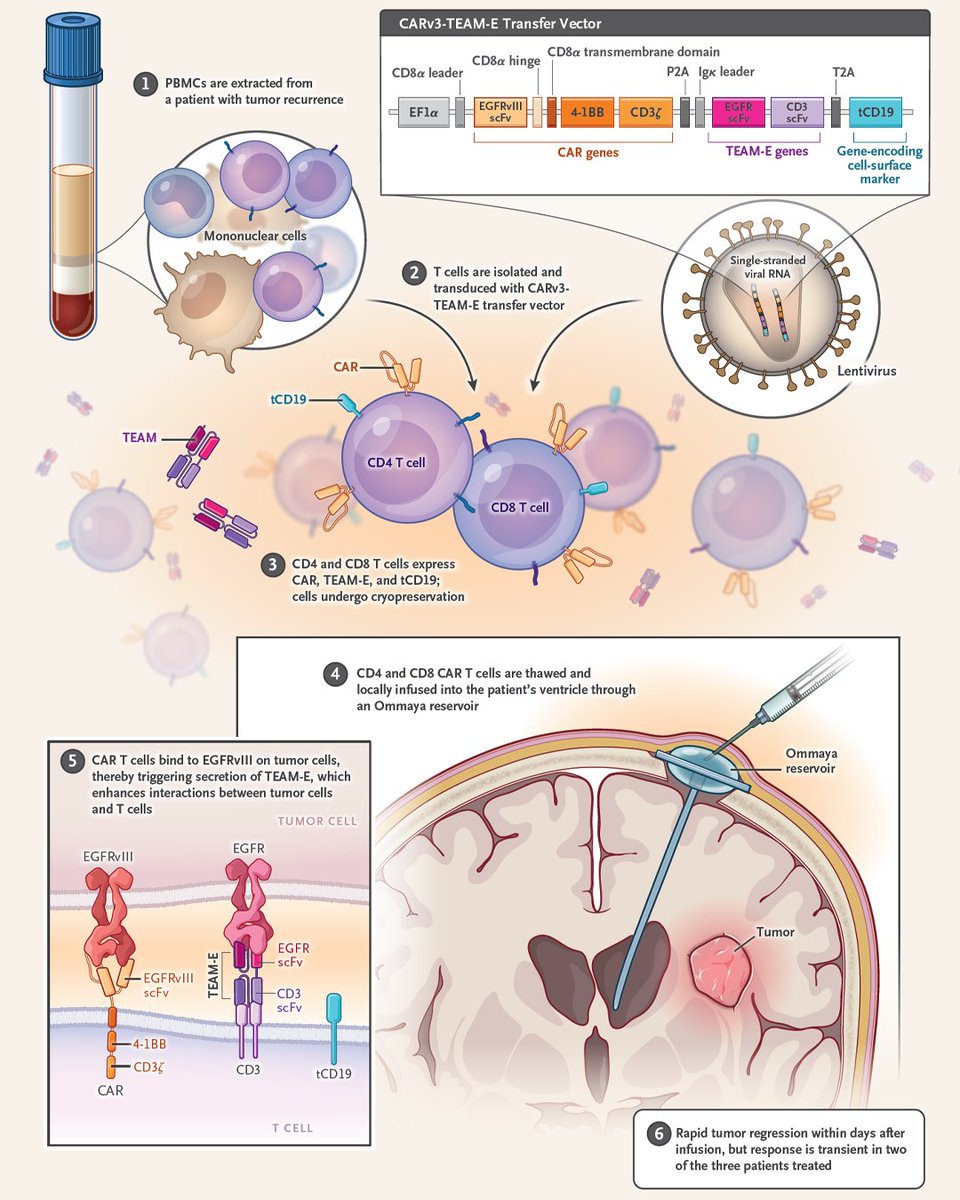 Most patients diagnosed with glioblastoma die within a year, so innovative therapeutic strategies are needed. An editorial describes the science behind one strategy using a secreting chimeric antigen receptor (CAR) T cell. Read the full editorial: nej.md/49yGoKf