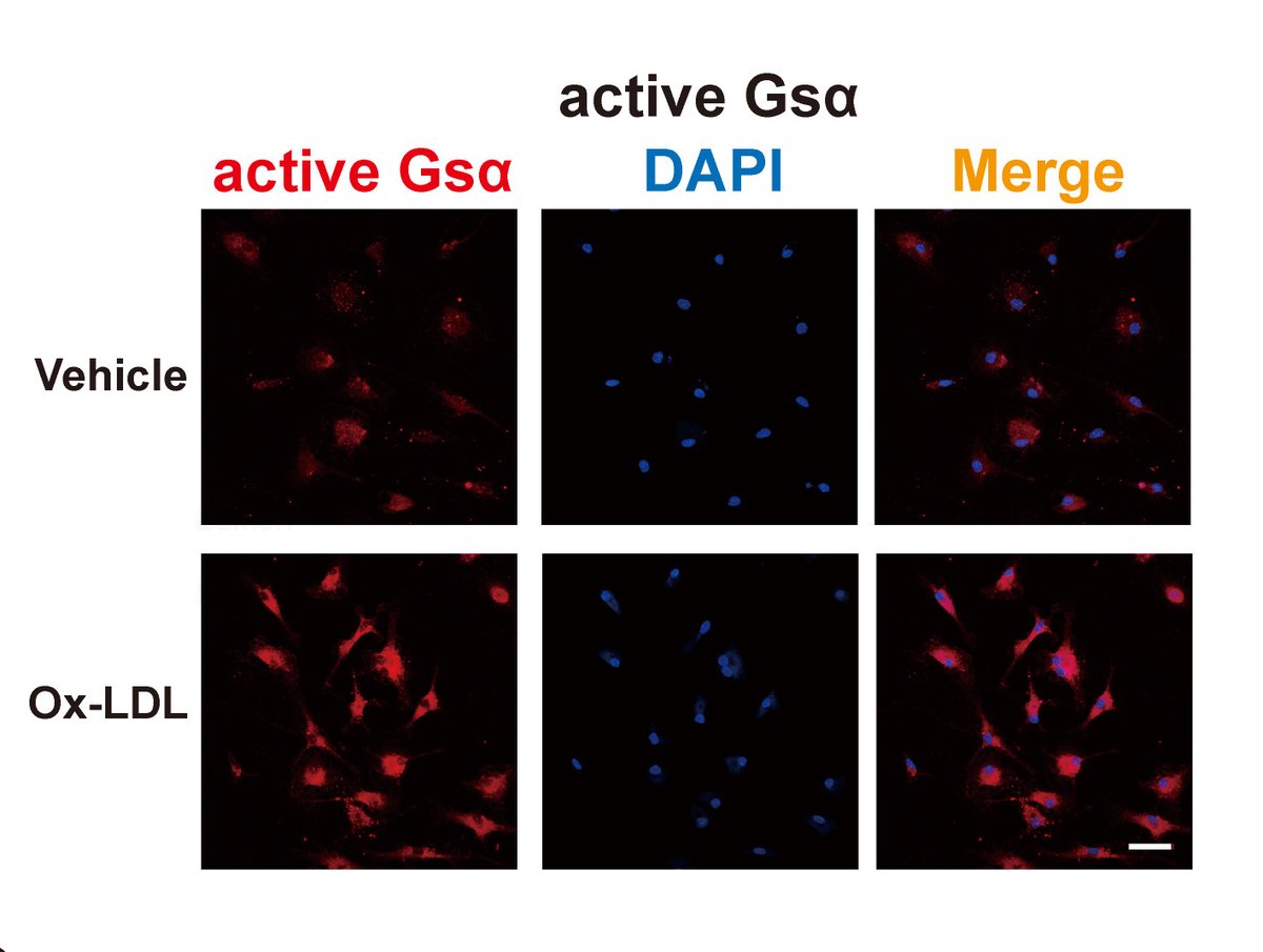Ma & colleagues found the pro-atherosclerotic role of #macrophage #Gsα. Learn more about #atherosclerotic prevention & treatment at ahajournals.org/doi/10.1161/CI… @changma656951 @ShandongU