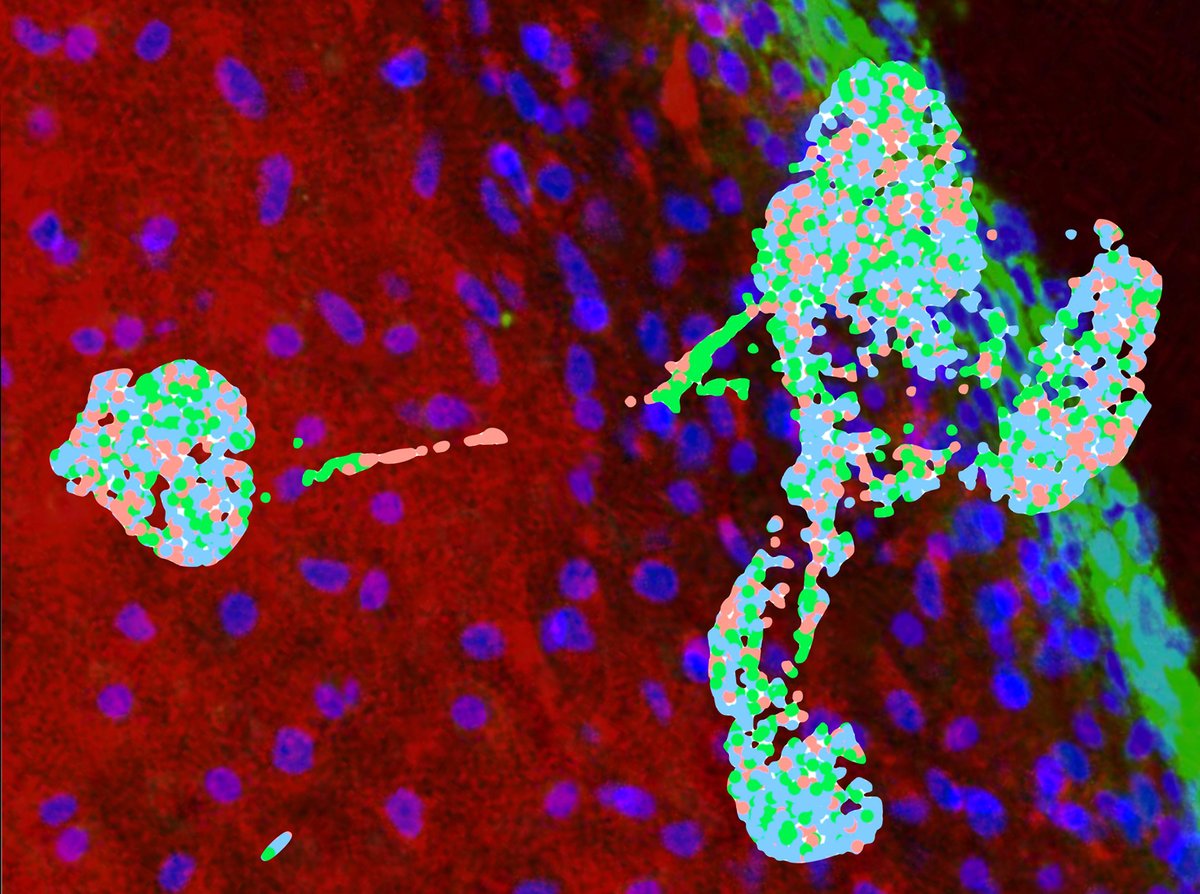 UM researchers have found a new method to generate human cartilage of the head and neck! Read more👉bit.ly/UMcartil @umontana #research #MT