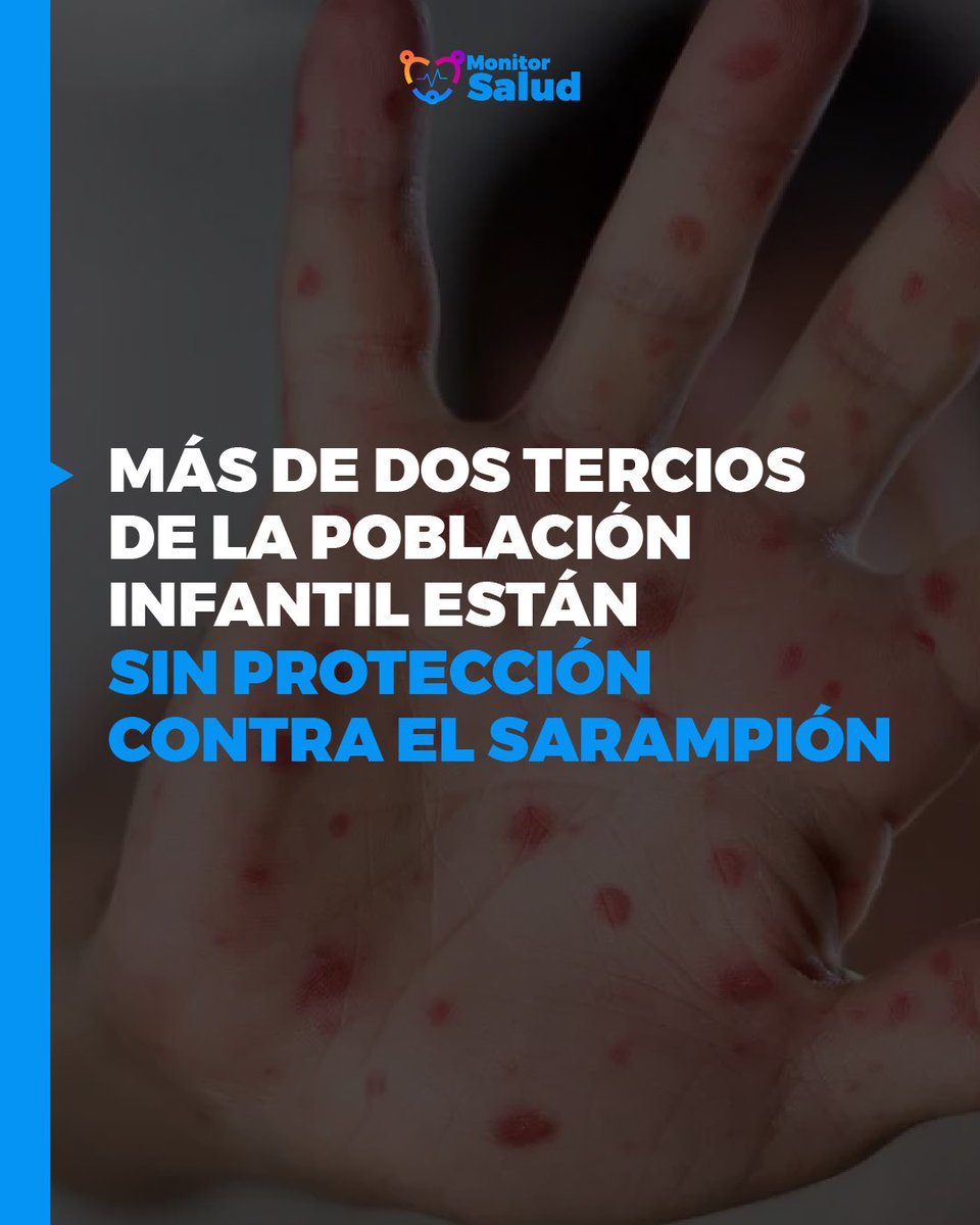 Alerta de salud pública en Venezuela: Con solo el 37% de la población vacunada con la segunda dosis contra el sarampión, estamos lejos del 90-95% recomendado por la OPS. Es crucial aumentar la cobertura para mantener nuestro estatus libre de sarampión. Más detalles en…