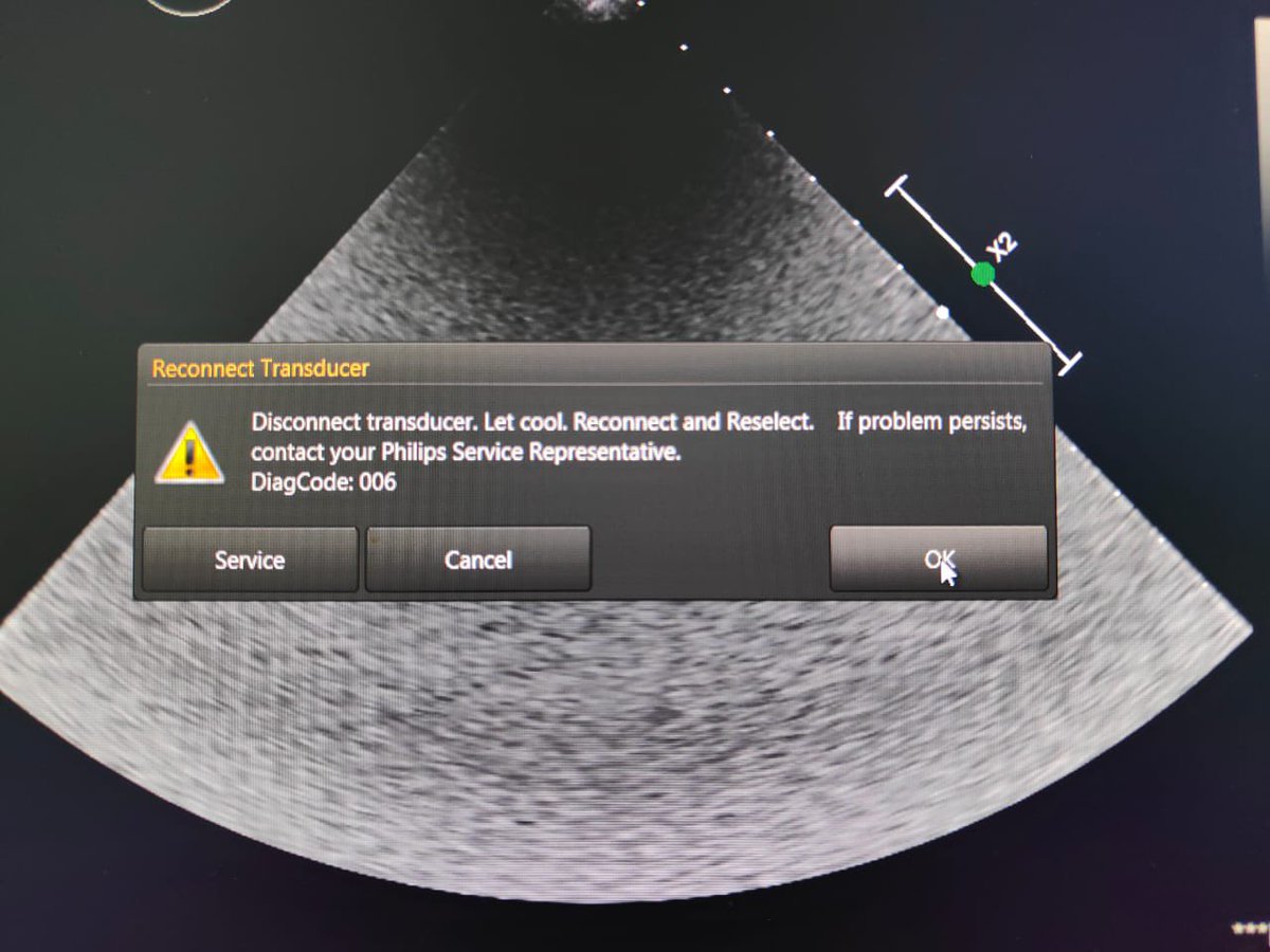 One of our customer is facing below problem with his matrix X5-1 Philips Epiq 7C: Can any body help? Or come across similar problem and have any solutions? Please help 🙏

#xmatrix #x51 #philips #epiq7c #probe #adultcardiac #cardiac #engineer #service #biomedical #bme