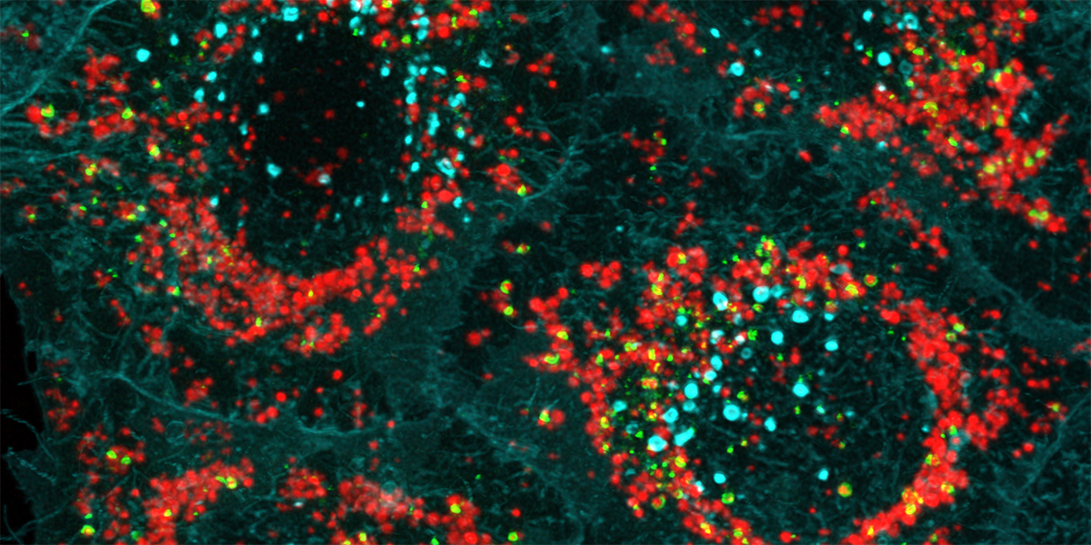 Today is #WorldParkinsonsDay.

A recent discovery led by researchers from WEHI and @univienna about how a protein helps remove damaged mitochondria from the body could help lead to potential new treatments for #ParkinsonsDisease.

Learn more 👇
wehi.edu.au/news/finding-r…