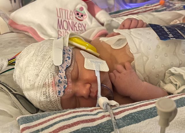 Copo_72's tweet photo. The youngest member of the 405 crew Brayleigh Elaine Copeland arrived at 8:24 Friday night 04/05/24 at 4lbs 14oz she had some set backs immediately after birth but showing steady progress every day and we can’t wait to bring her home https://t.co/rjpMEPPZ69