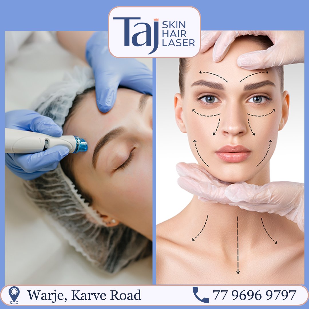 Kothrud_com's tweet photo. Dr. Sayali Patil's Taj Skin Hair Laser Clinic. A reliable clinic for treating all Skin Problems! 
Contact : 7796969797
https://t.co/XbqAiRCl9E
#TajSkinHairLaserClinic #SkincareSolutions #HealthySkin #RadiantSkin https://t.co/l98n4wThlh
